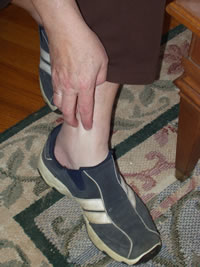 Woman scratching ankle