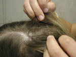 searchin child's hair for head lice