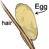 Head louse nit